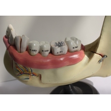 牙列及磨牙解剖模型
